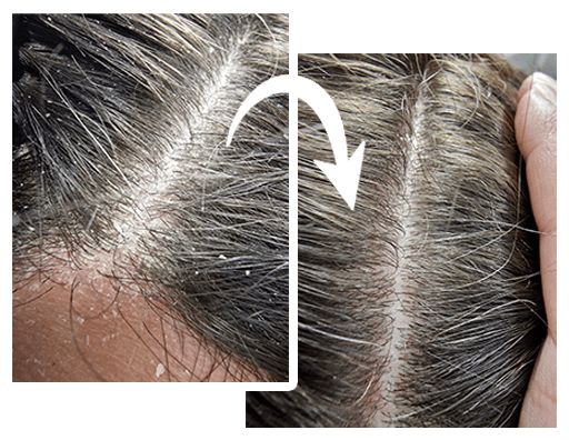 Sauerstoff vorher nachher